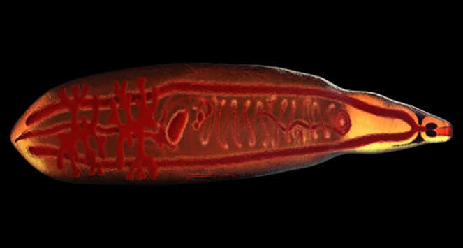 a microscopic image of a liver fluke